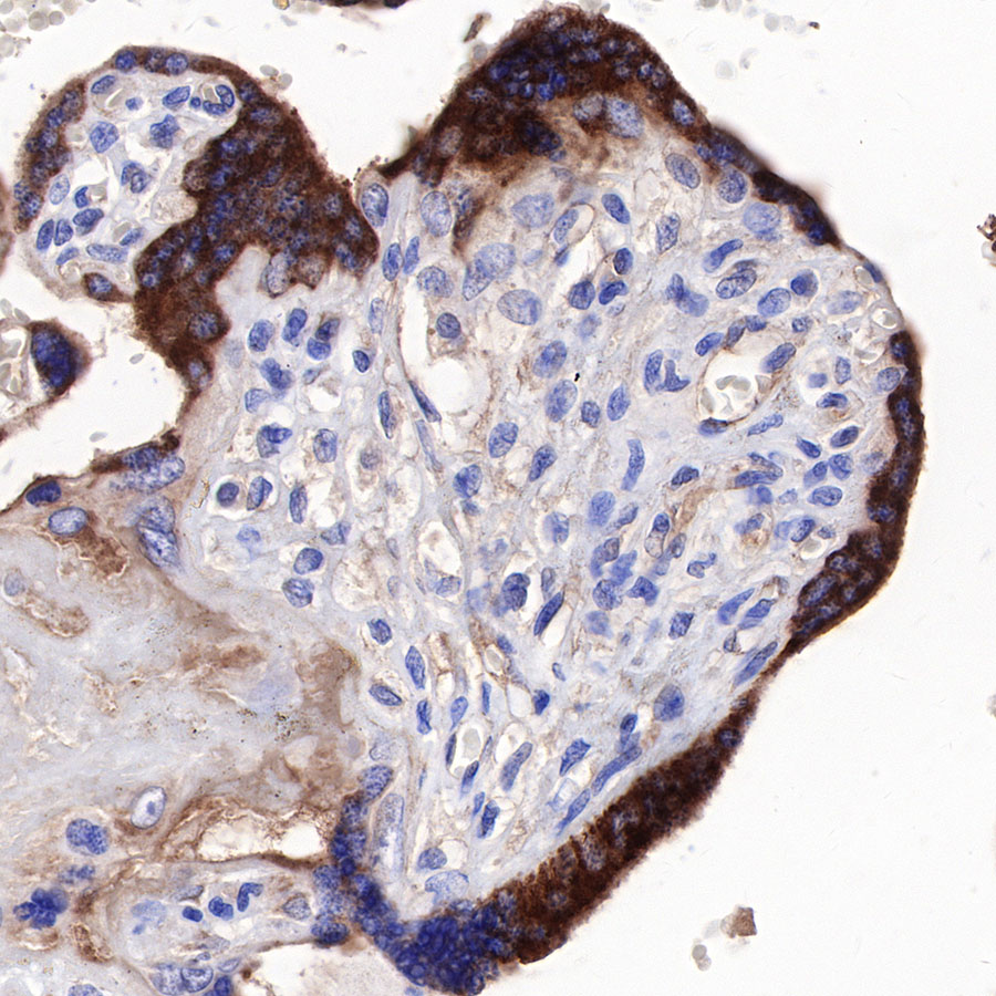 sFlt-1/VEGF Receptor 1 Recombinant Rabbit mAb (SDT-233-29)