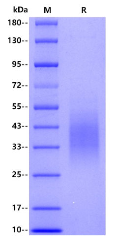 Human CD28, His tag