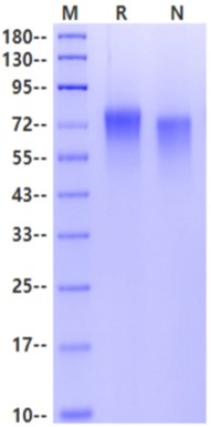 Nectin-3/CD113 His Tag Protein, Human