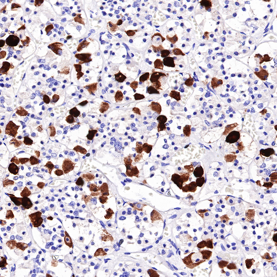 ACTH Recombinant Rabbit mAb (SDT-363-60)
