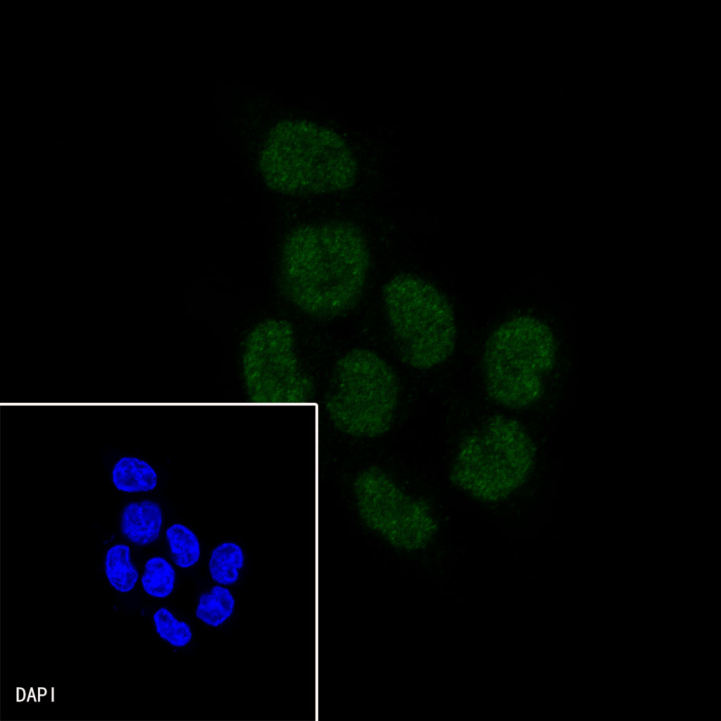 CDX2 Recombinant Rabbit mAb (SDT-134-76)