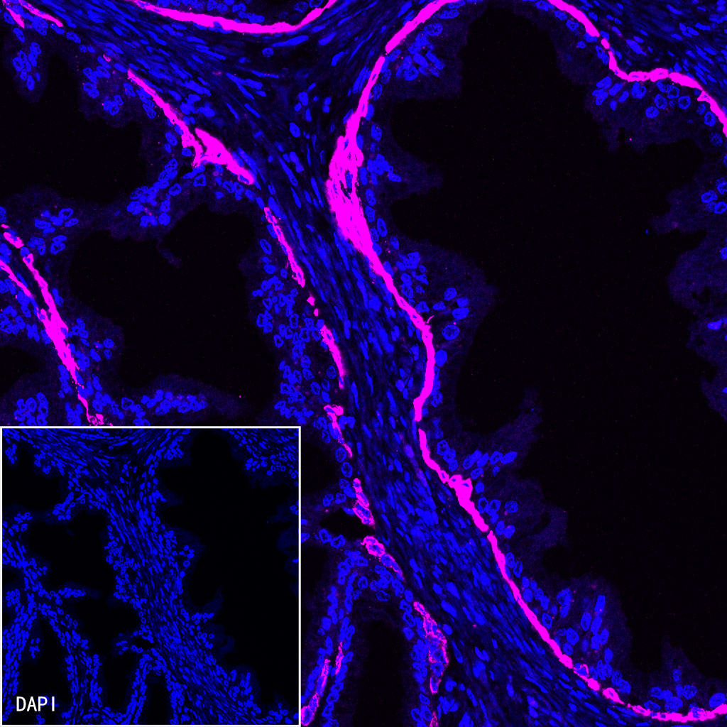 S-RMab® CK5/6 Recombinant Rabbit mAb (SDT-P004)