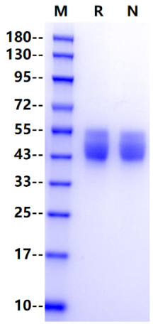 IL10RA/CD210 His Tag Protein, Human