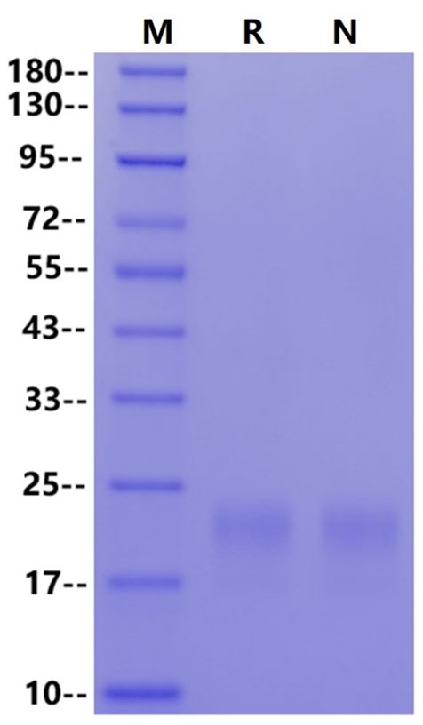 CEACAM-3/CD66d His Tag Protein, Human