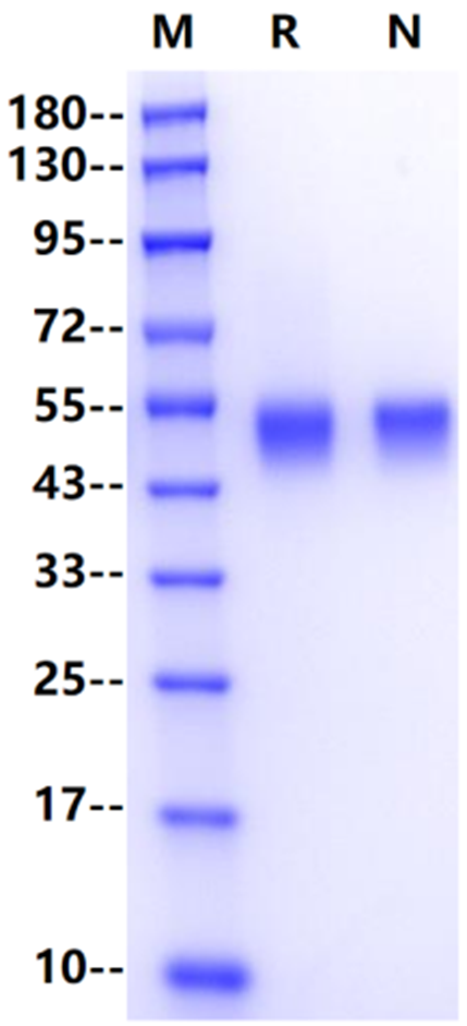 IGFBP-3 His Tag Protein, Human