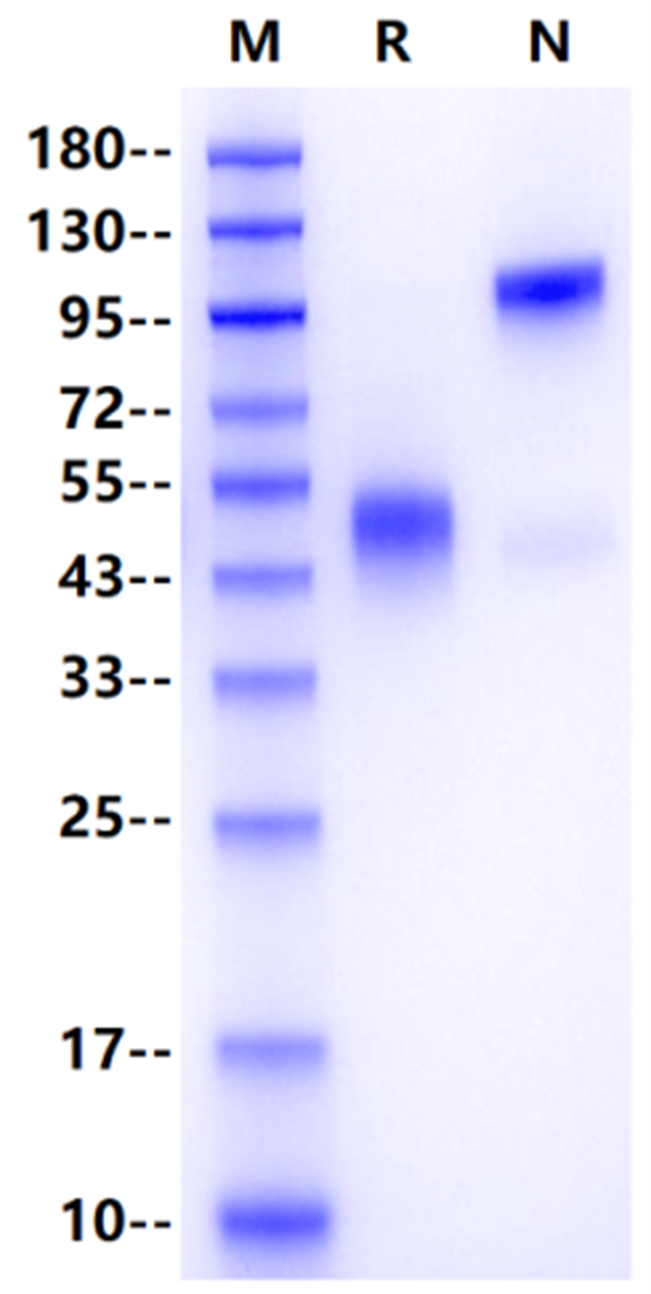 ALK-1/ACVRL1 Fc Chimera Protein, Human