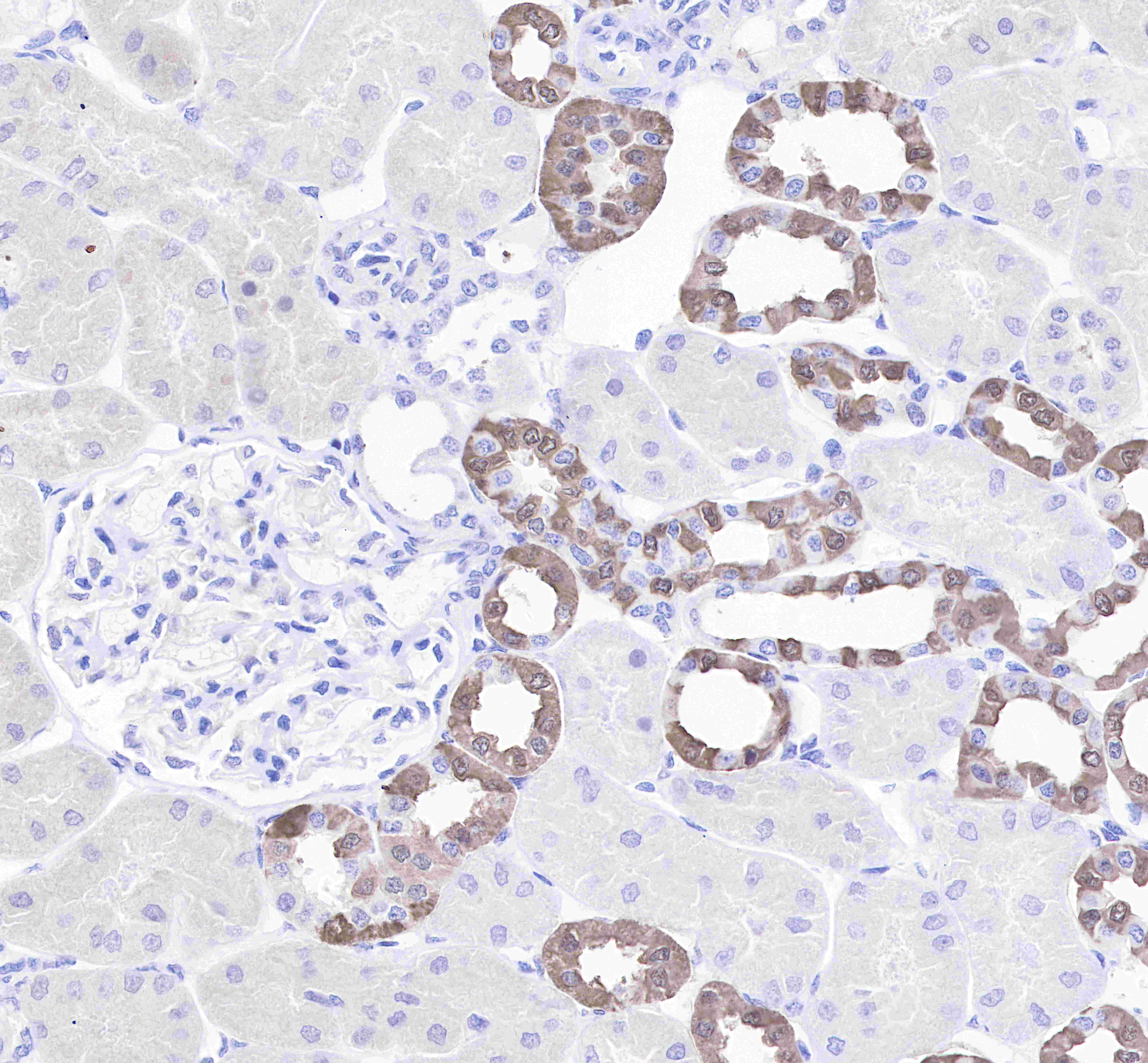 Calbindin Recombinant Rabbit mAb(SDT-034-11)