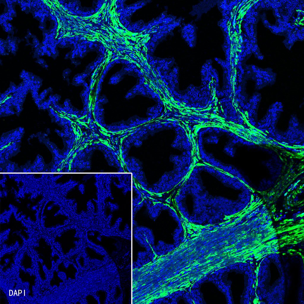 alpha smooth muscle Actin Recombinant Rabbit mAb (Alexa Fluor® 488 Conjugate) (SDT-132-63)