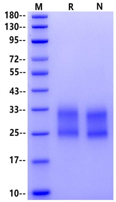 Frizzled-7/FZD7 His Tag Protein, Human