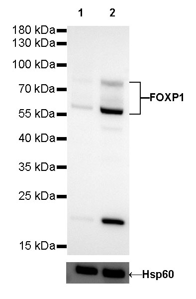 FOXP1 Recombinant Rabbit mAb (SDT-R053)