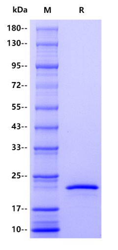 Human Occludin Protein, His tag