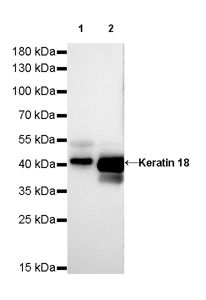 Keratin 18 Recombinant Rabbit mAb (SDT-R081)