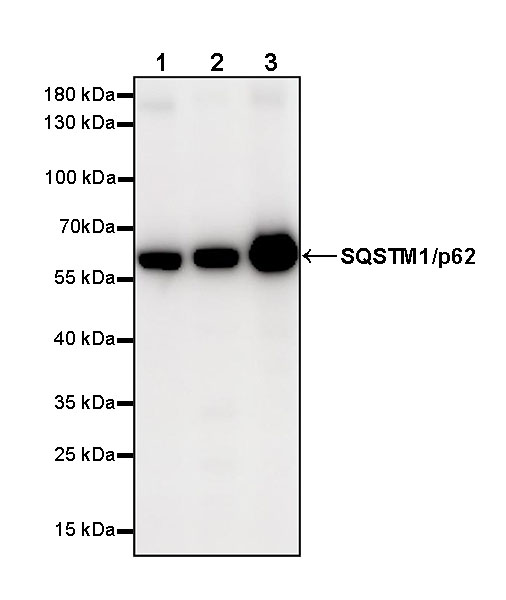 SQSTM1/p62 Recombinant Rabbit mAb (S-R346)