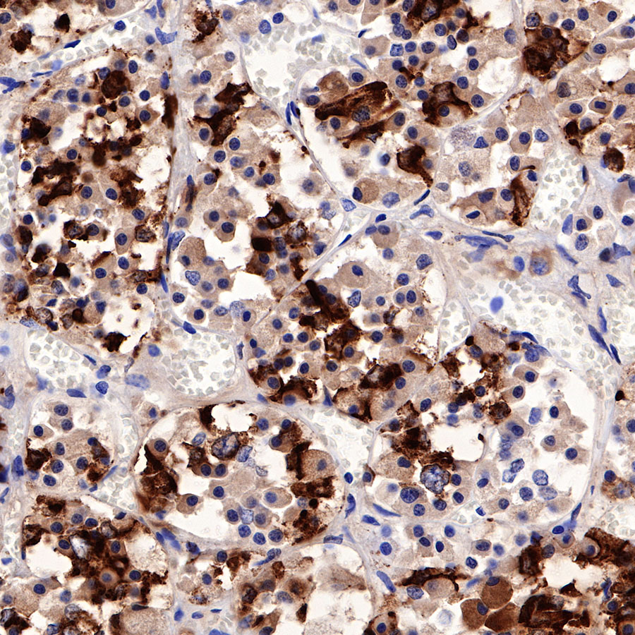 Prolactin/PRL Recombinant Rabbit mAb (SDT-235-13)