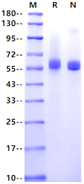 TIMP1 Fc Chimera Protein, Human