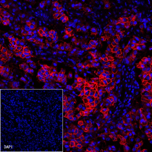 ErbB2 Recombinant Rabbit mAb (Alexa Fluor® 555 Conjugate) (S-069-57)