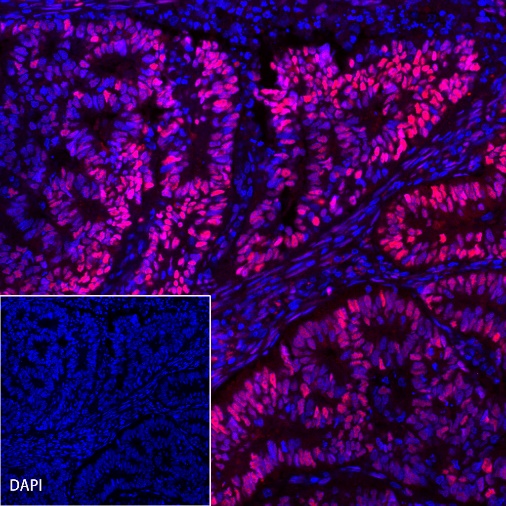 Progesterone Receptor Recombinant Rabbit mAb (Alexa Fluor® 555 Conjugate) (SDT-R123)
