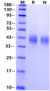 CD200 His Tag Protein, Human