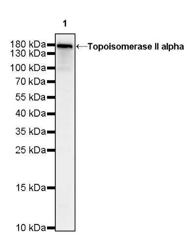 Topoisomerase II alpha Recombinant Rabbit mAb (S-513-7)