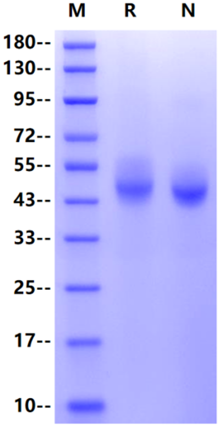FCRL6/FcRH6 His Tag Protein, Human