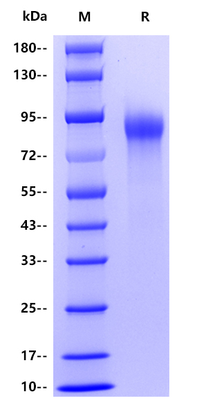 Human CD6, His tag