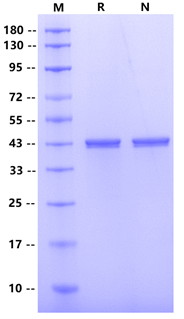 HRSVB(Strain 18537）Nucleoprotein ,His tag Protein