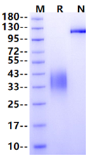 BTLA His Tag Protein, Mouse