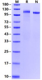 LDLR(D193A) His Tag Protein, Human