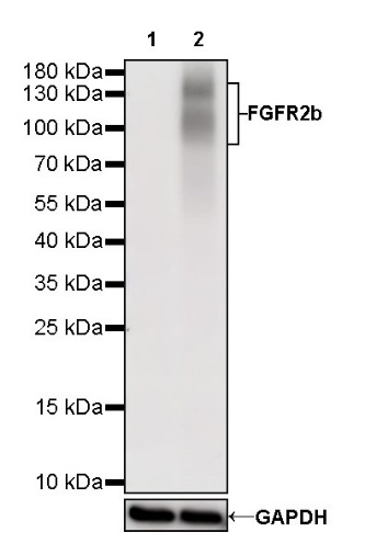 FGFR2b Recombinant Rabbit mAb (SDT-423-2)