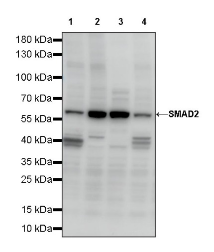 SMAD2 Rabbit Polyclonal Antibody