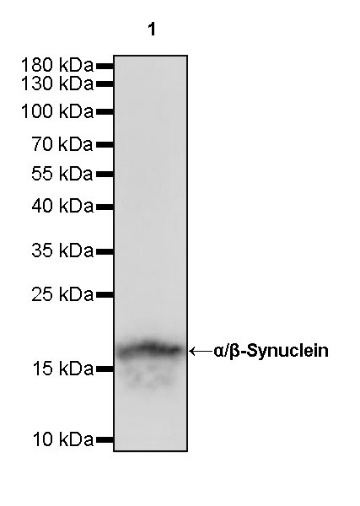 α/β-Synuclein Recombinant Rabbit mAb (S-309-72)