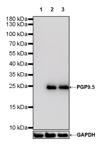 PGP9.5 Recombinant Rabbit mAb (S-R281)