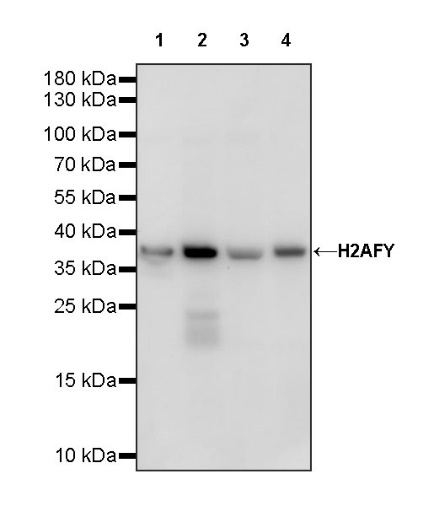 H2AFY Recombinant Rabbit mAb (S-1256-35)