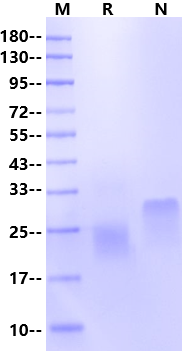 FSH α&β Heterodimer His Tag Protein, Human