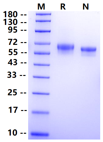Biotinylated ROR1 His&Avi Tag Protein, Human/Cynomolgus/Rhesus macaque
