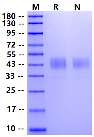 Biotinylated ANGPTL3(17-220) His&Avi Tag Protein, Human