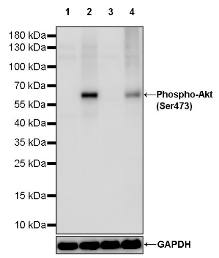 Phospho-Akt (Ser473) Recombinant Rabbit mAb (S-510-163)