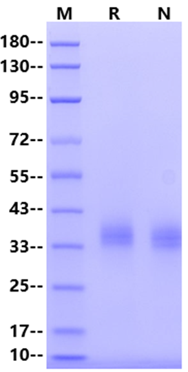 Siglec-15 His Tag Protein, Human