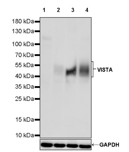 VISTA Recombinant Rabbit mAb (S-1469-72)
