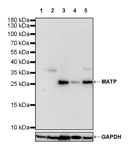 MTAP Recombinant Rabbit mAb (S-813-23)