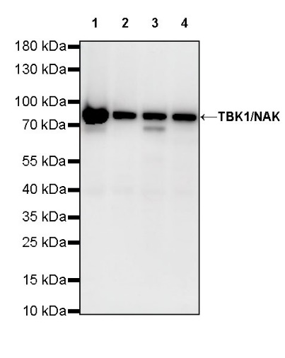 TBK1/NAK Recombinant Rabbit mAb (S-658-50)