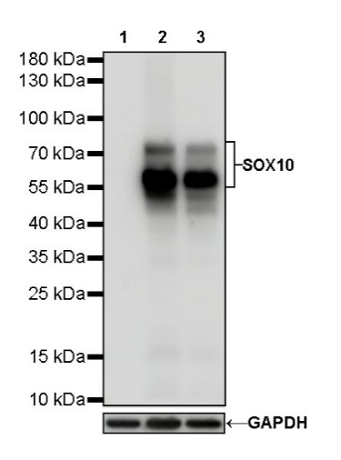 S-RMab® SOX10 Recombinant Rabbit mAb (SDT-R233)