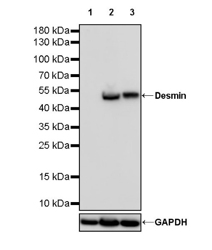 S-RMab® Desmin Recombinant Rabbit mAb (SDT-109-114)