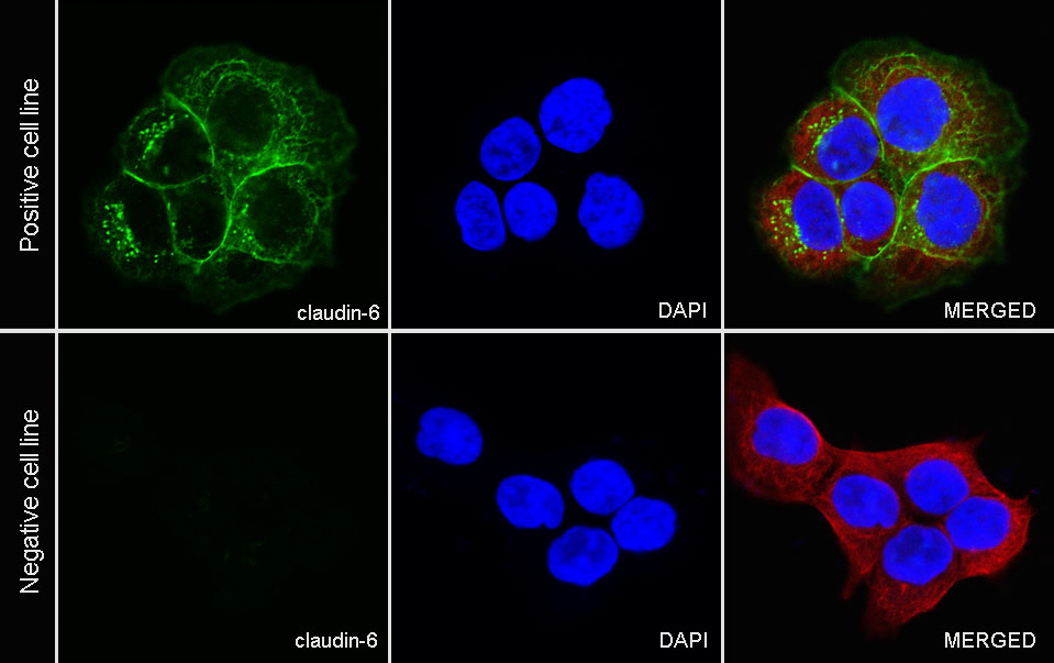 Claudin 6 Recombinant Rabbit mAb (S-521-63)