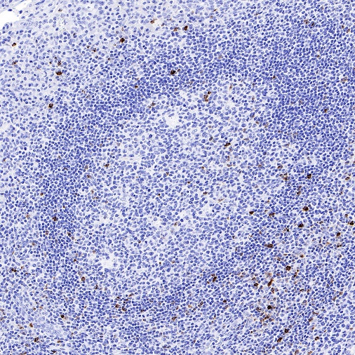 LAG3 Recombinant Rabbit mAb (S-671-74)