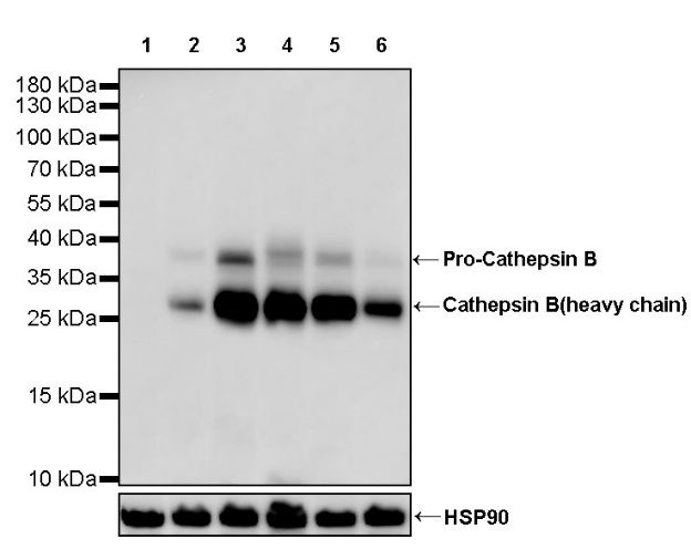 Cathepsin B Recombinant Rabbit mAb (S-1067-7)