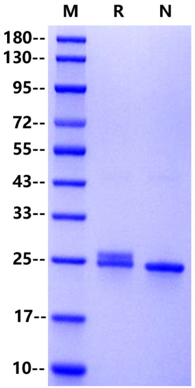 C-Reactive Protein(CRP) His Tag, Human