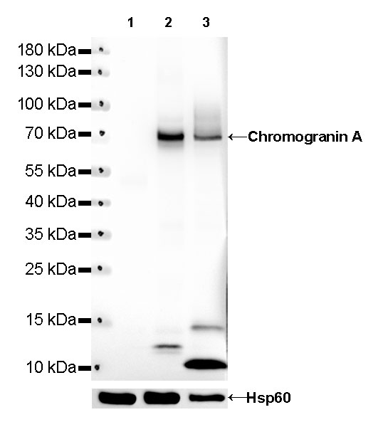 Chromogranin A Recombinant Rabbit mAb (SDT-R042)