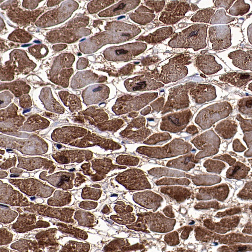 Cardiac Troponin I Recombinant Rabbit mAb (S-1352-15)