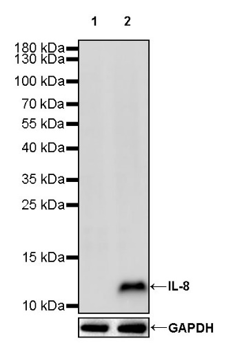 IL-8 Recombinant Rabbit mAb (S-162-38)